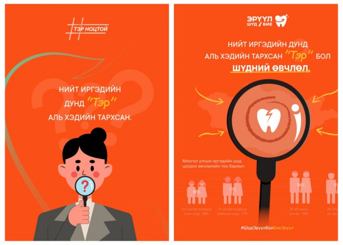 "Тэр" бол "Шүдний өвчлөл"