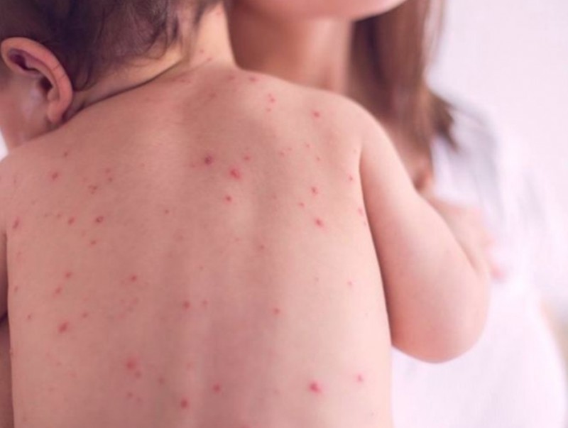 Улаан бурханы өндөржүүлсэн бэлэн байдалтай холбоотойгоор ХӨСҮТ маргааш ажиллана