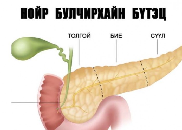 2023 оноос нойр булчирхай шилжүүлэн суулгах эмчилгээг эх орондоо хийнэ