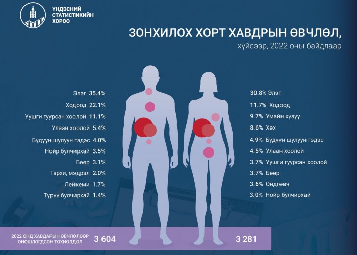 Монгол Улсад хорт хавдрын өвчлөлийн улмаас 26,347 хүн хяналтад байна