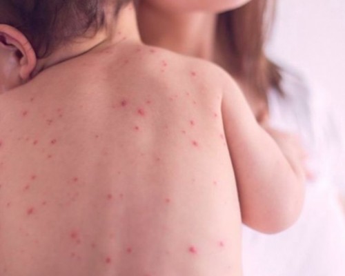 Улаан бурханы өндөржүүлсэн бэлэн байдалтай холбоотойгоор ХӨСҮТ маргааш ажиллана